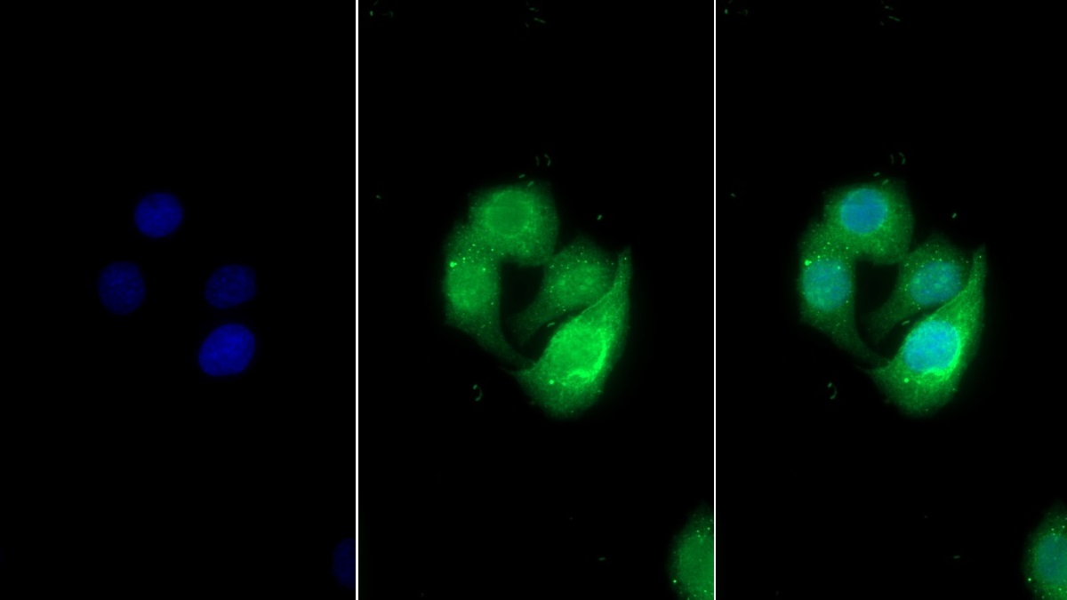 Polyclonal Antibody to Uromodulin (UMOD)