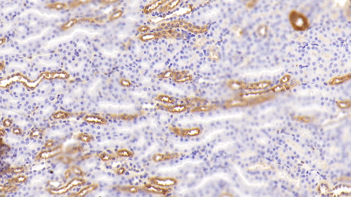 Polyclonal Antibody to Uromodulin (UMOD)