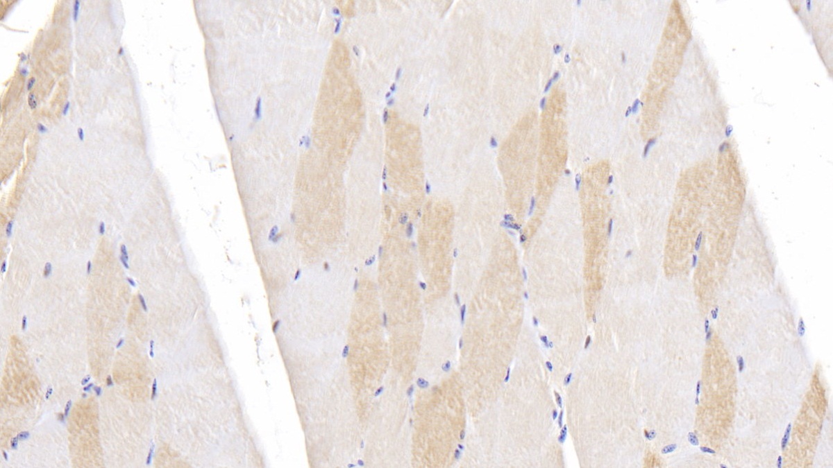 Polyclonal Antibody to Ubiquitin Carboxyl Terminal Hydrolase L5 (UCHL5)