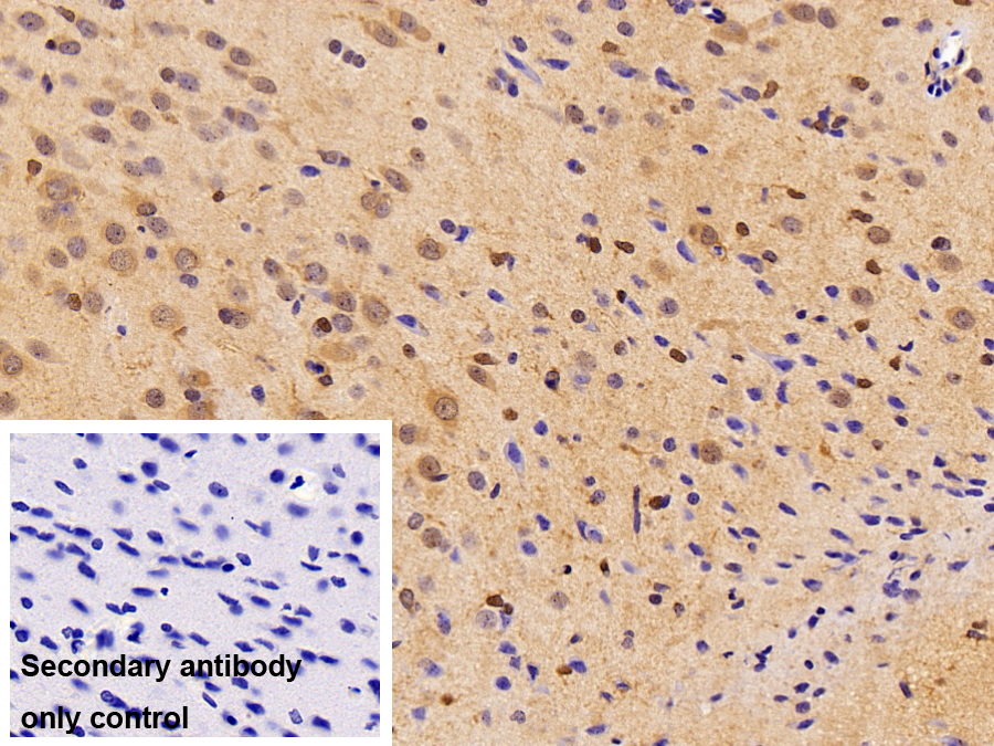 Polyclonal Antibody to Ubiquitin Carboxyl Terminal Hydrolase L3 (UCHL3)