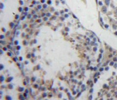 Polyclonal Antibody to Ubiquitin Carboxyl Terminal Hydrolase L3 (UCHL3)