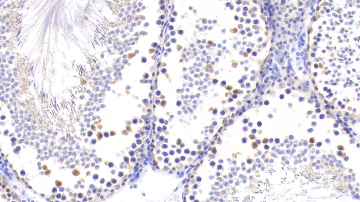 Polyclonal Antibody to Ubiquitin Carboxyl Terminal Hydrolase L1 (UCHL1)