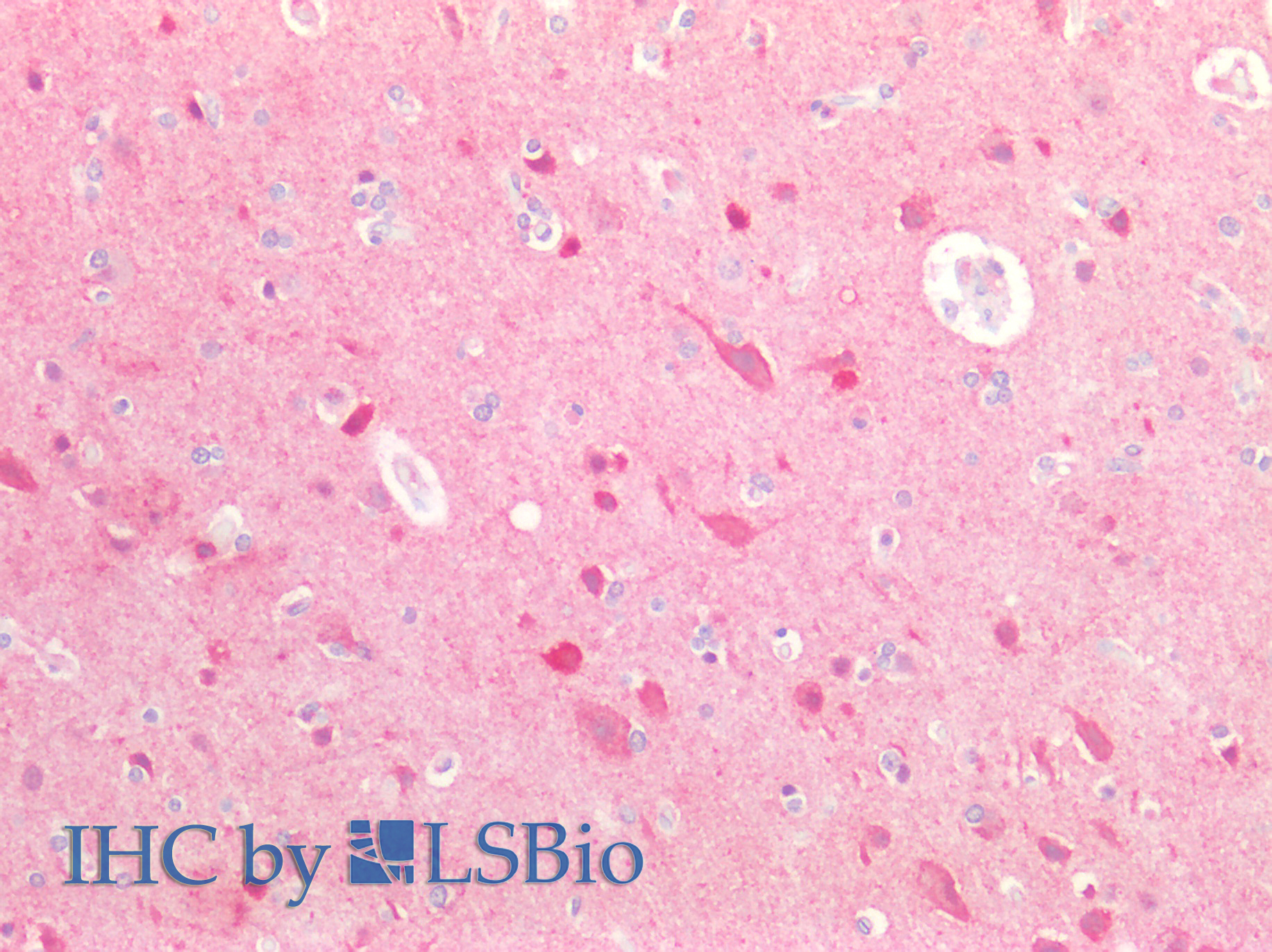 Polyclonal Antibody to Ubiquilin 2 (UBQLN2)