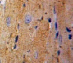 Polyclonal Antibody to Tumor Protein, Translationally Controlled 1 (TPT1)