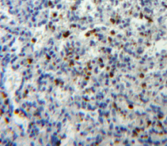 Polyclonal Antibody to Glutaredoxin (GLRX)