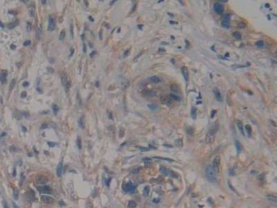 Polyclonal Antibody to TTK Protein Kinase (TTK)