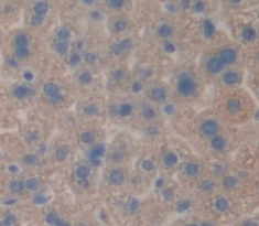 Polyclonal Antibody to Alpha-Tocopherol Transfer Protein (TTPa)