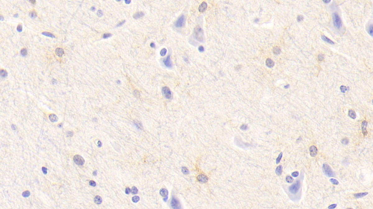 Polyclonal Antibody to Transformation/Transcription Domain Associated Protein (TRRAP)