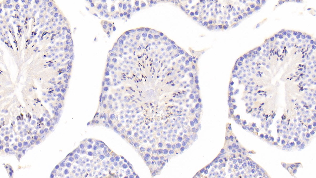 Polyclonal Antibody to Toll Like Receptor Adaptor Molecule 2 (TICAM2)