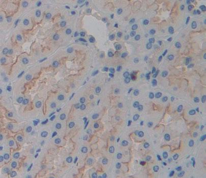 Polyclonal Antibody to Trans Golgi Network Protein 2 (TGOLN2)