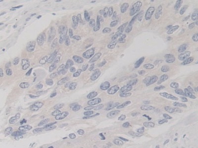 Polyclonal Antibody to TANK Binding Kinase 1 (TBK1)