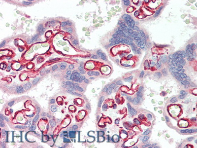 Polyclonal Antibody to Sulfatase 2 (SULF2)