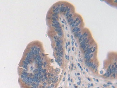 Polyclonal Antibody to STAM Binding Protein (STAMBP)