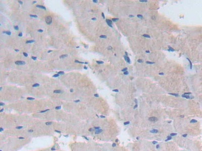 Polyclonal Antibody to Signal Transducing Adaptor Protein 1 (STAP1)