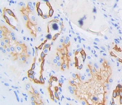 Polyclonal Antibody to Serine Palmitoyltransferase, Long Chain Base Subunit 3 (SPTLC3)