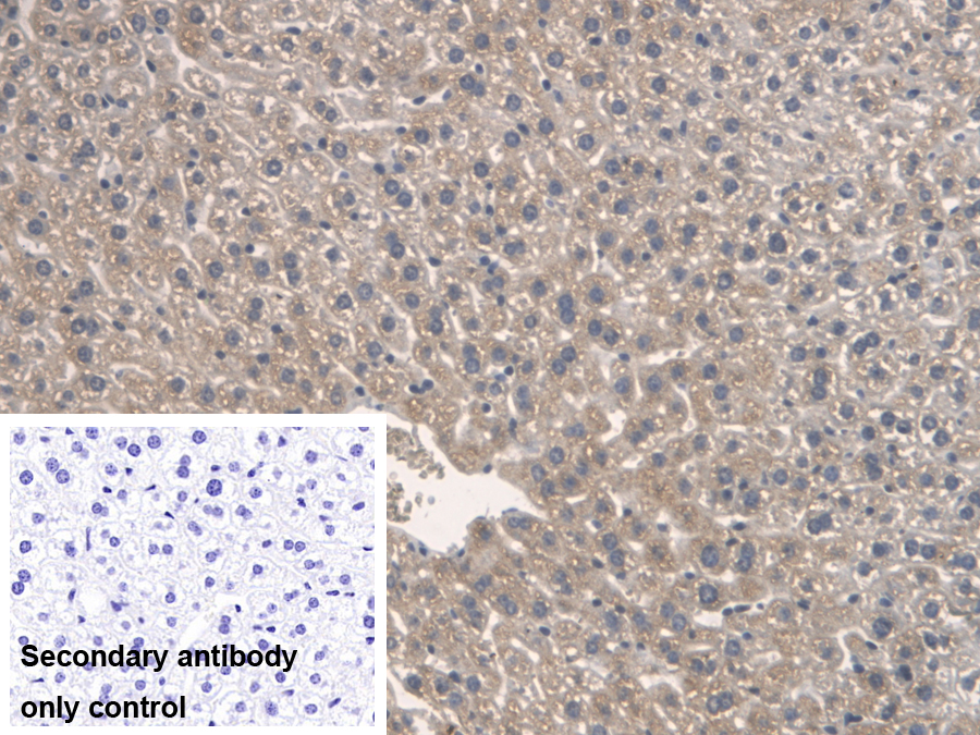 Polyclonal Antibody to Serine Palmitoyltransferase, Long Chain Base Subunit 1 (SPTLC1)