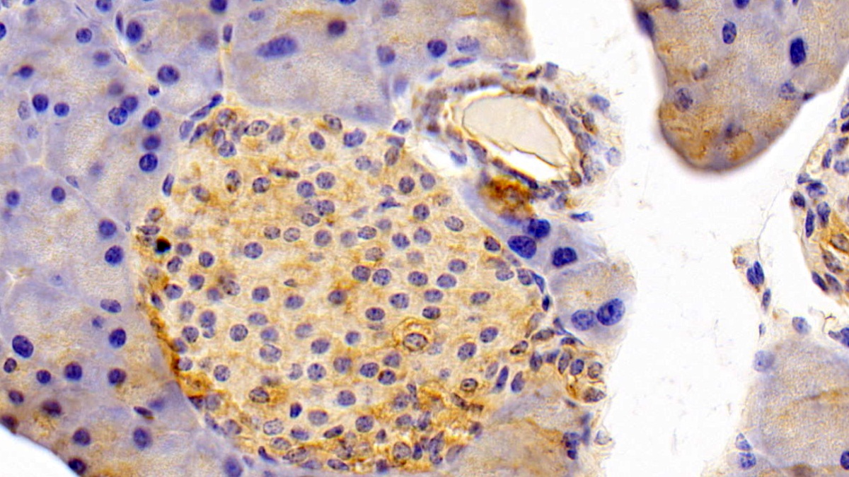 Polyclonal Antibody to Sepiapterin Reductase (SPR)