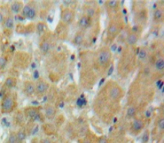 Polyclonal Antibody to Serine Peptidase Inhibitor Kazal Type 1 (SPINK1)