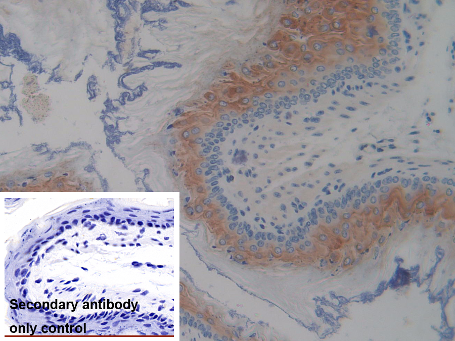 Polyclonal Antibody to Serine Peptidase Inhibitor Kazal Type 5 (SPINK5)