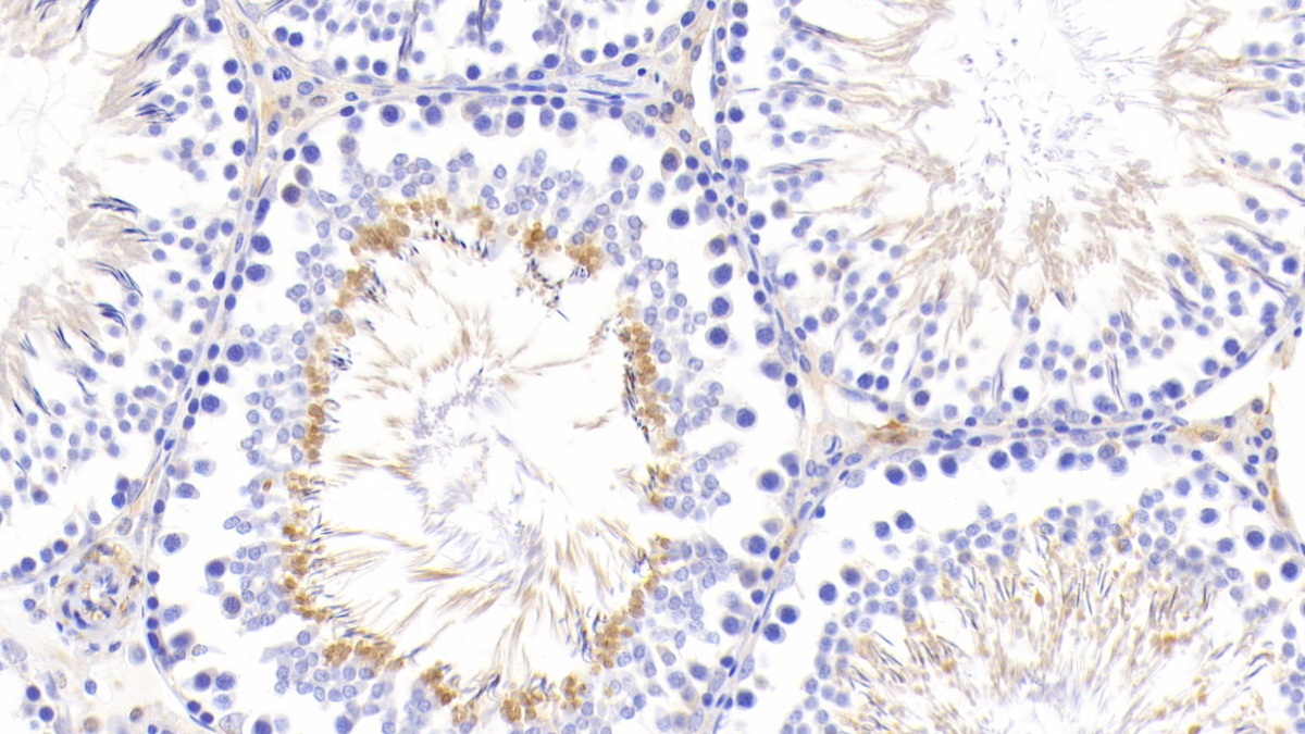 Polyclonal Antibody to Suppressors Of Cytokine Signaling 2 (SOCS2)