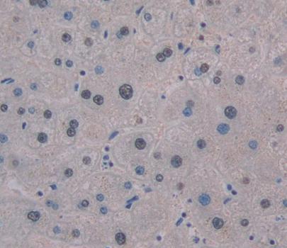 Polyclonal Antibody to Single Strand Selective Monofunctional Uracil DNA Glycosylase 1 (SMUG1)