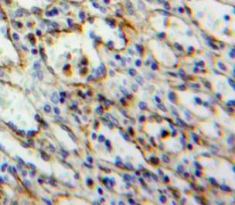 Polyclonal Antibody to Signaling Threshold Regulating Transmembrane Adaptor 1 (SIT1)