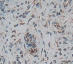 Polyclonal Antibody to Stratifin (SFN)