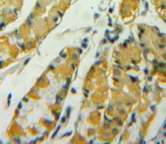 Polyclonal Antibody to Stratifin (SFN)