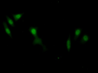 Polyclonal Antibody to Scavenger Receptor Class B Member 1 (SCARB1)