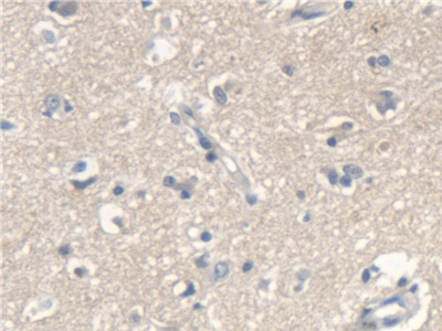 Polyclonal Antibody to Scavenger Receptor Class A Member 5 (SCARA5)