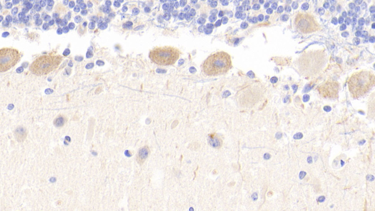 Polyclonal Antibody to Riboflavin Kinase (RFK)