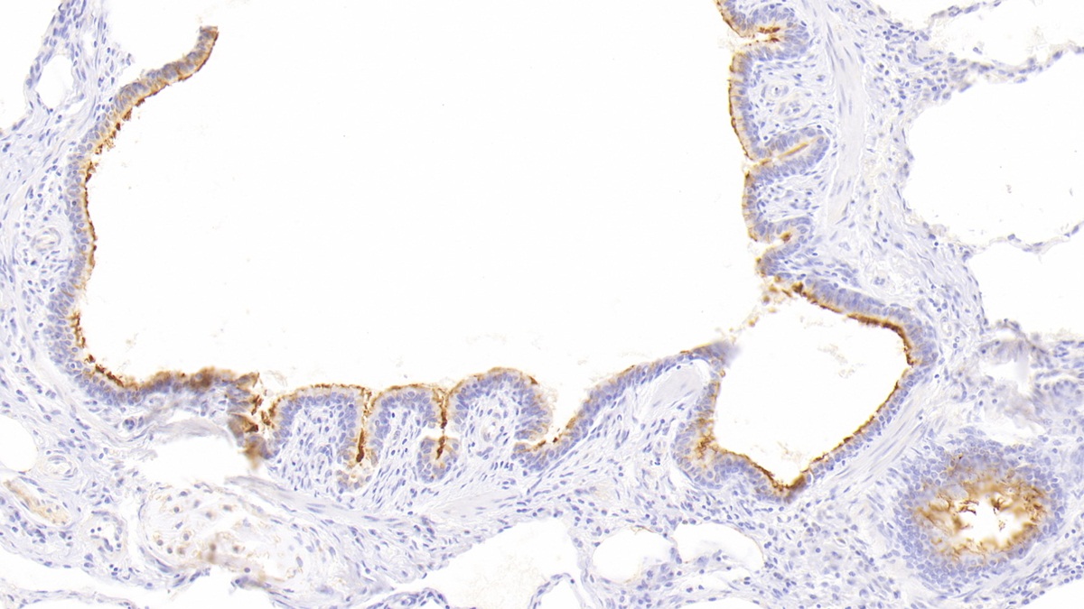 Polyclonal Antibody to RalA Binding Protein 1 (RALBP1)