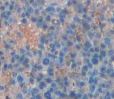 Polyclonal Antibody to Glutaminyl Peptide Cyclotransferase (QPCT)