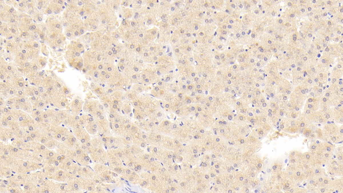 Polyclonal Antibody to Preferentially Expressed Antigen In Melanoma (PRAME)