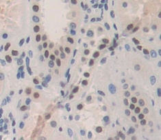 Polyclonal Antibody to Preferentially Expressed Antigen In Melanoma (PRAME)