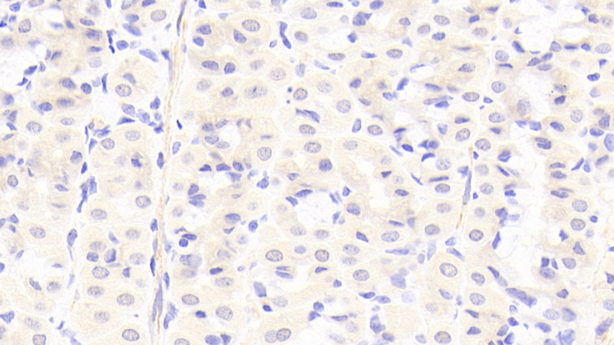 Polyclonal Antibody to Periplakin (PPL)