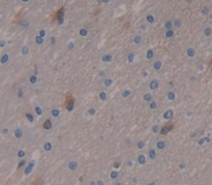 Polyclonal Antibody to Periplakin (PPL)