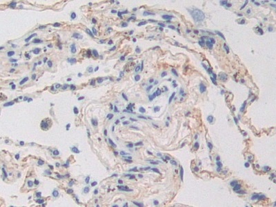 Polyclonal Antibody to Periostin (POSTN)