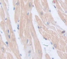 Polyclonal Antibody to Periostin (POSTN)