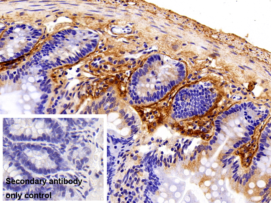 Polyclonal Antibody to Periostin (POSTN)