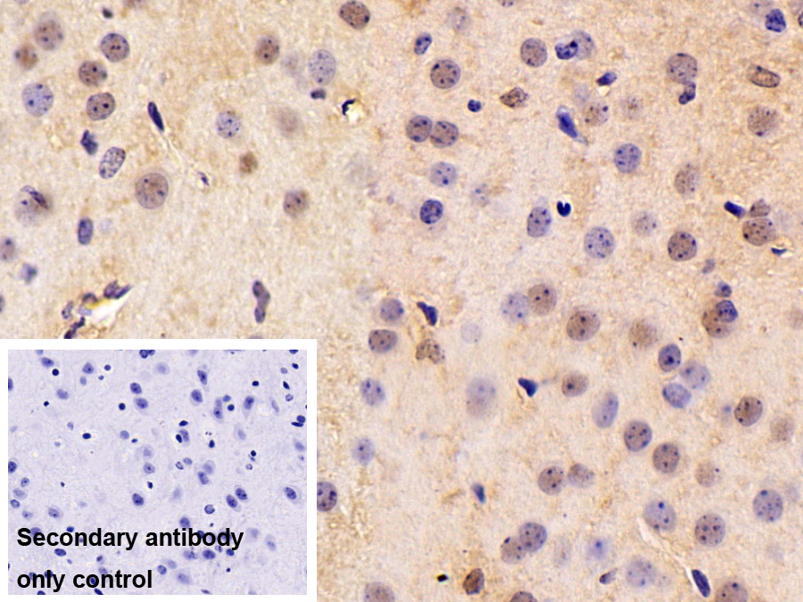 Polyclonal Antibody to Paraneoplastic Antigen MA2 (PNMA2)