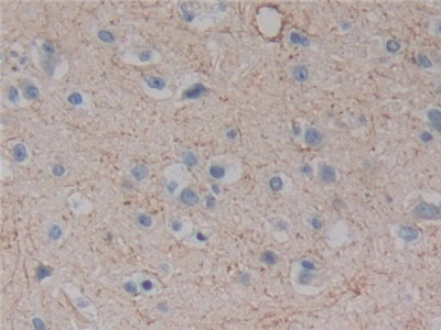 Polyclonal Antibody to Plexin A1 (PLXNA1)