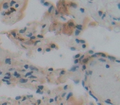 Polyclonal Antibody to Palate/Lung And Nasal Epithelium Associated Protein (PLUNC)