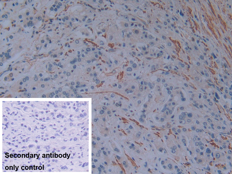 Polyclonal Antibody to Plastin 3 (PLS3)