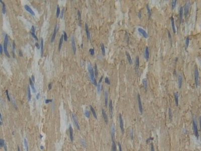 Polyclonal Antibody to Plastin 3 (PLS3)