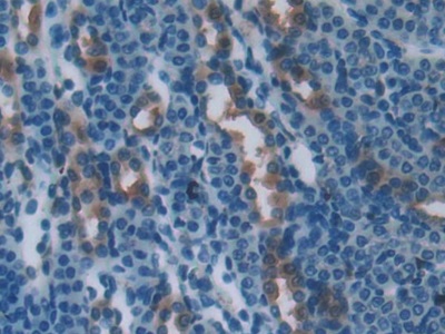 Polyclonal Antibody to Plastin 3 (PLS3)