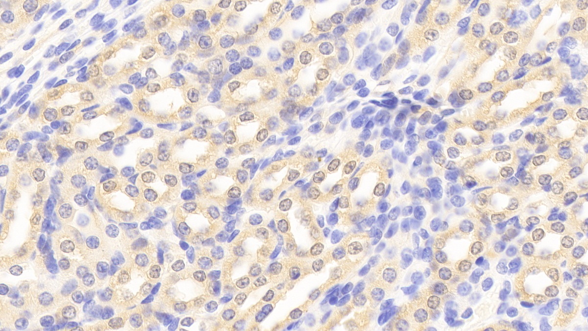 Polyclonal Antibody to Phosphohistidine Phosphatase 1 (PHPT1)