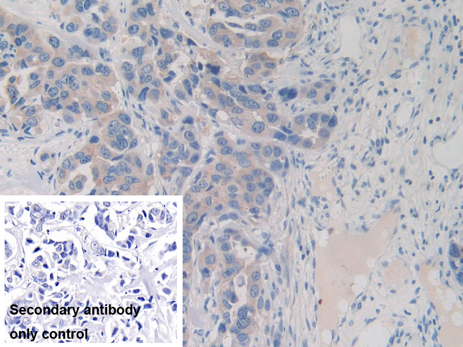 Polyclonal Antibody to Pyruvate Dehydrogenase Complex Component X (PDHX)