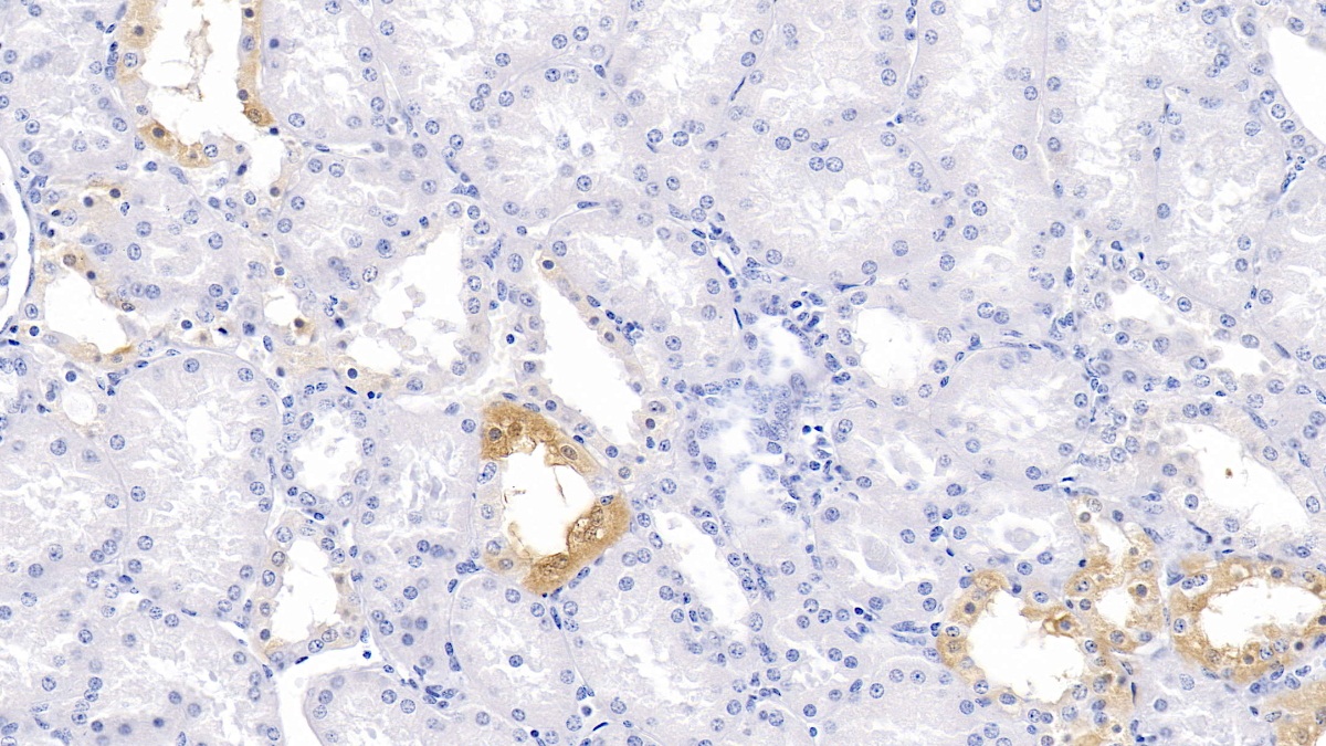 Polyclonal Antibody to Polybromo 1 (PBRM1)