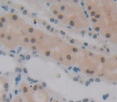 Polyclonal Antibody to Polybromo 1 (PBRM1)